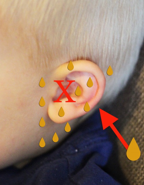 How to Apply Essential Oils to the Ear Sweet T Makes Three